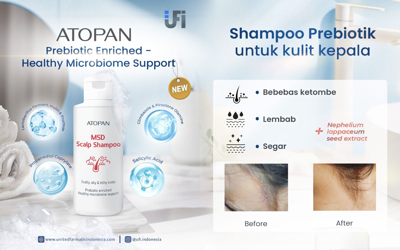 Atopan-Official-IMG- (2)