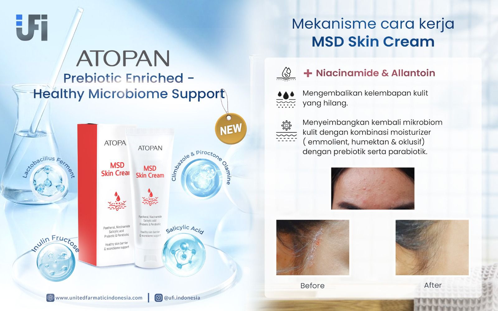 Atopan-Official-IMG- (4)